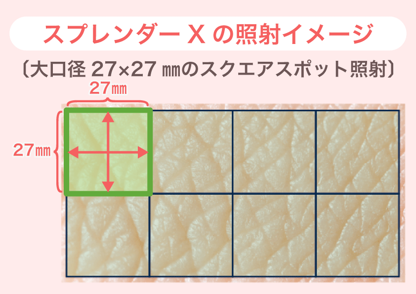 スプレンダーXの照射イメージ（27×27mmスクエア）