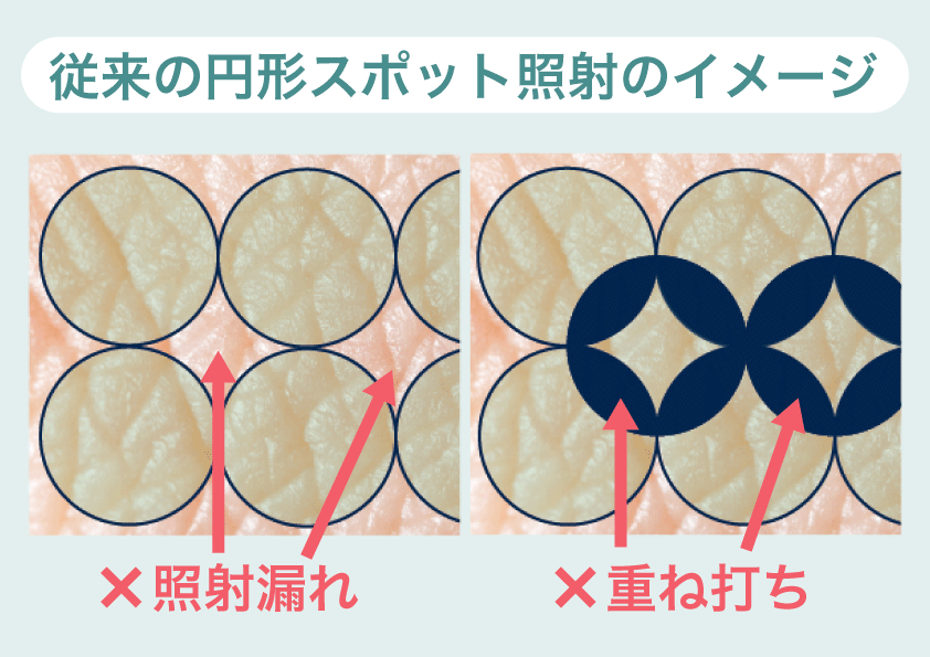 従来の円形スポット照射イメージ