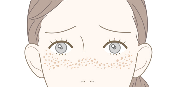 そばかす・あざ